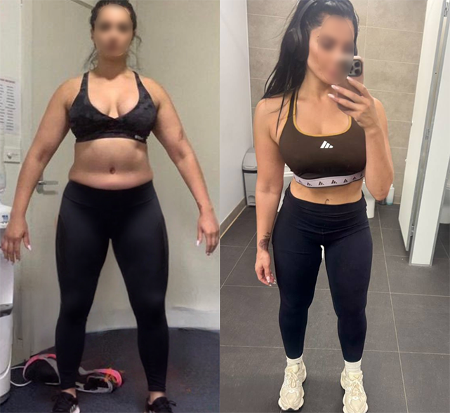Alicia, 32, before and after